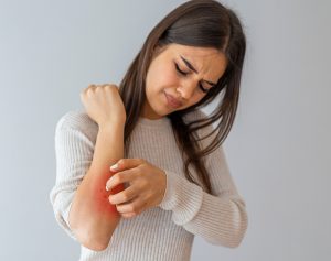 Six Tips to Control Your Atopic Dermatitis (Eczema)