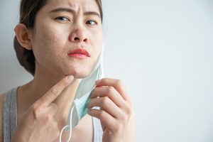 Don’t Let Your Face Mask Ruin Your Skin: 6 Tips to Avoiding Maskne
