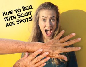 5 Tips on Dealing with Scary Age Spots