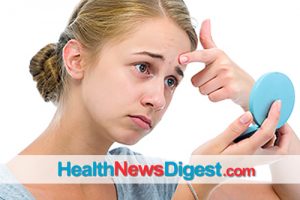 Serious Treatment for Serious Acne: Unleashing the Power of Isotretinoin