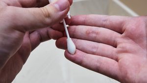 Dealing with Warts: Frogs have nothing to do with it