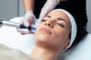 How Micro-needling Works To Make You Look Younger