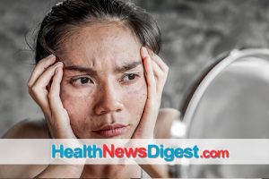 5 Tips to Putting a Stop to Blotchy and Discolored Skin