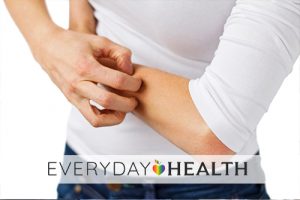 Are Your Atopic Dermatitis Symptoms Under Control?