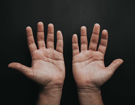 Hand Surgery for Dupuytren’s Contracture Service Photo1