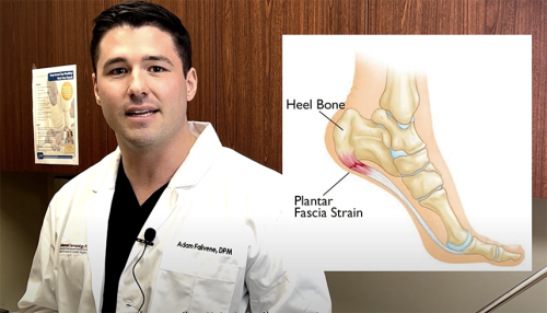 Foot Pains? Dr. Adam Falivene explains Plantar Fasciitis.
