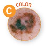 Melanoma color small photo