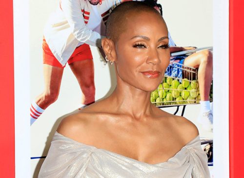 When Balding Became News; Jada Pinkett Smith has Alopecia. Tips on Protecting Hair, and Preventing Alopecia.
