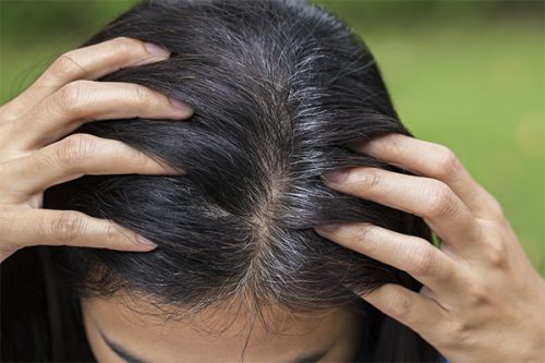 Can dermatologists treat gray hair?