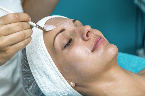 What are the advantages of a chemical peel?