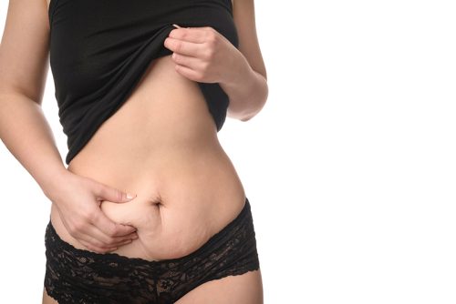 5 Desirable Tummy Tuck Surgery Results