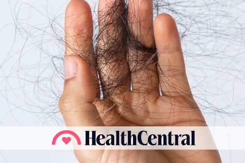 What to Ask Your Doc About Alopecia
