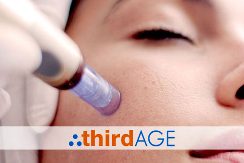 micro needling, microneedling