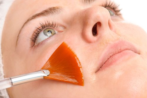 What are the Benefits of Chemical Peel?