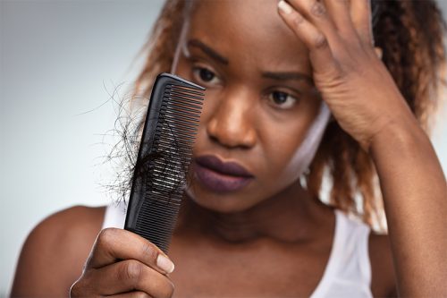 What Kind of Doctor Should You See for Hair Loss?