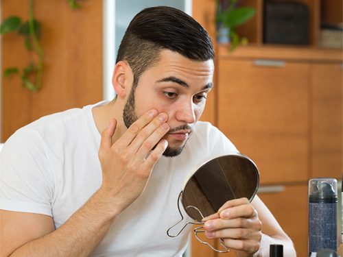 What is the Best Cosmetic Treatment for Dark Circles?