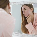 ACNE AND ECZEMA