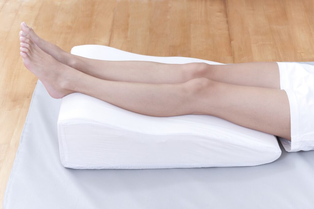 elevating legs - varicose treatment